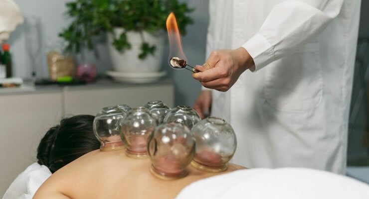 Massagem com Ventosas: Removendo Bloqueios de Energia e Aliviando a Dor 6 massagem com ventosa